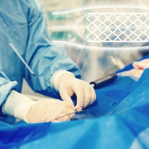 Cirugía Endovascular CDMX